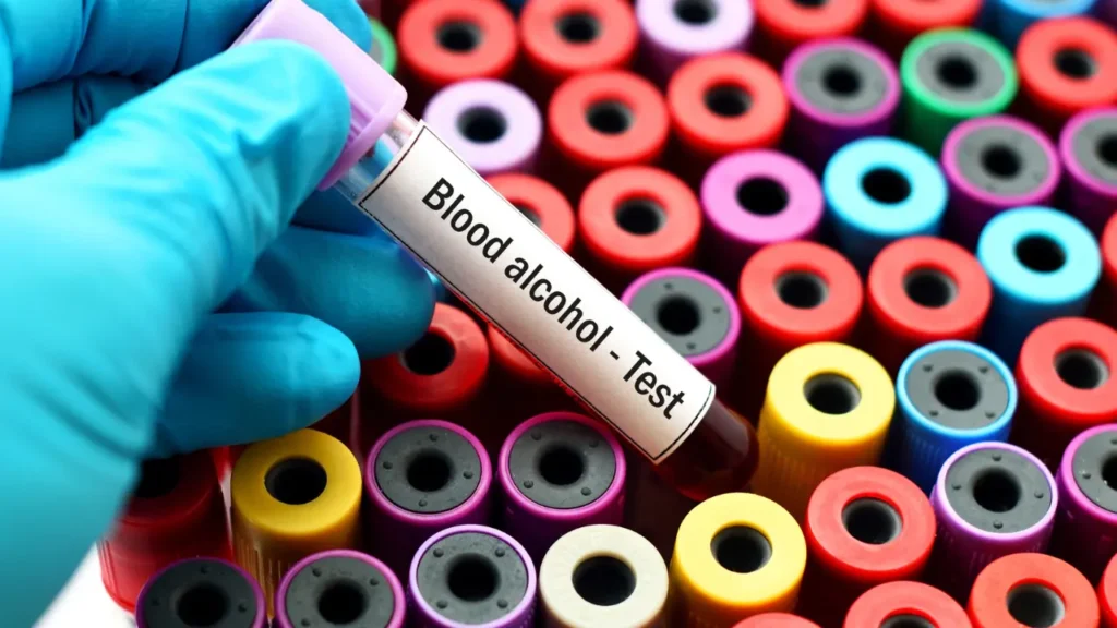 A gloved hand holds a blood sample tube labeled "Blood alcohol - Test" in a medical setting. The tube is surrounded by other blood collection tubes with colorful caps, including red, yellow, purple, and blue, indicating various tests. The image relates to an alcohol assessment through a blood alcohol test.