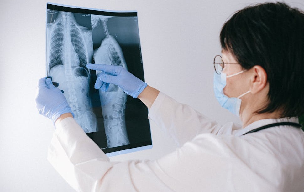 cervical spine injury settlements Winston-Salem