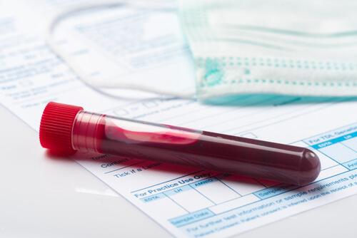 How Do You Challenge a Blood Draw That Results in a DWI?